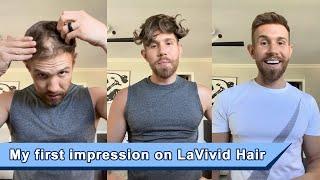 Product Review : Hair System from LaVivid Hair - Male Pattern Hair Loss