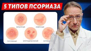 Какой у вас тип псориаза? Определить и вылечить, 10 Видов псориаза!