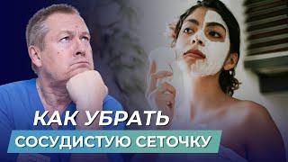  ШОК! КАК УБРАТЬ СОСУДИСТУЮ СЕТОЧКУ самостоятельно и БЕЗ ДОРОГИХ ПРОЦЕДУР?