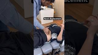 Navel displacement | gas and acidity treatment #trending #shortfeed #drharishgrover