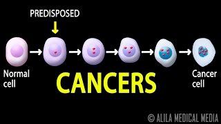 Cancer, How Cancer Starts, How Cancer Spreads, Where and Why, Animation.