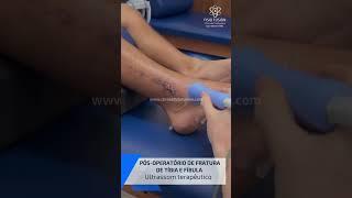 FRATURA #saude #reabilitação #sports #shorts #reels #fisioterapia #futebol #joelho #pe #tornozelo
