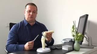 Индивидуальный имплантат коленного сустава - преимущества для пациентов с остеоартрозом