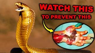 SO YOU WANT TO KEEP VENOMOUS SNAKES?