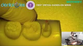 FIRST VIRTUAL HANDS ON SERIES   drg  Aditya Wisnu Putranto , Sp KG K   DENTALITIES 2020