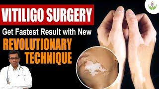 Get Fastest Result with New Revolutionary Technique in Vitiligo Surgery | Care Well Medical Centre