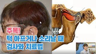 주목! 턱관절 디스크 치료법 | 입 안 벌어질 때, 턱에서 소리날 때