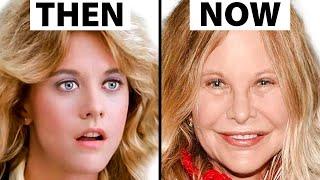 Meg Ryan's NEW FACE | Plastic Surgery Analysis