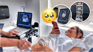 FIRST Ultrasound + Hearing The HEARTBEAT *emotional*