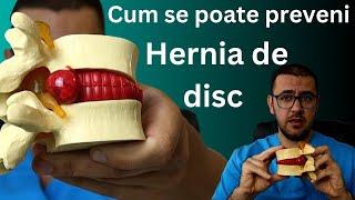 Cum se poate preveni hernia de disc