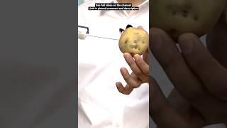 How a biopsy for cancer diagnosis is done | With help of potato | Dr. Gaurav Gangwani