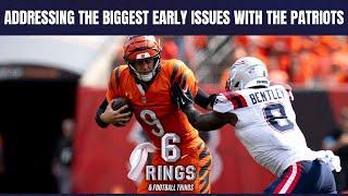 Defensive injuries & Offensive Inefficiency Plaguing Pats: Live @6ringspod