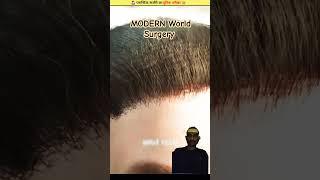 HAIR RESTORATION | Modern World Surgery #education #shorts #greenscreen #reactionvideo #reaction