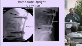 Spinal Instrumentation: Basic Concepts & Biomechanics by Paul Anderson, M.D.