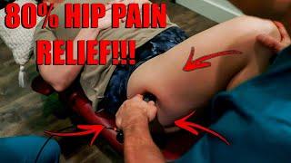 Sciatica or Hip Pain? Discover the Surprising Solution for Lasting Relief!