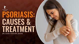 Psoriasis | Causes and Treatment | DR ALKA VIJAYAN