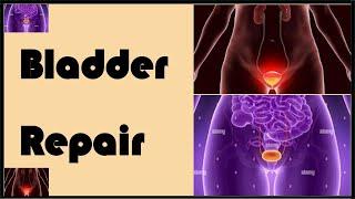 Bladder Repair | Urinary Bladder Repair | Obstetrics and Gynaecology