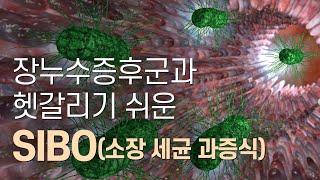 소장세균과증식(SIBO)의 증상, 원인, 진단, 치료