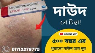 দাউদের/দাদ ও চুলকানির সবচেয়ে ভালো ঔষধ ডেরোবিন|डेरोबिन क्रीम किस काम में आता है | দাদের ওষুধ Derobin