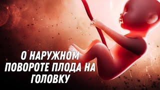 О наружном повороте плода на головку #doctorberezovska #olenaberezovska #беременность