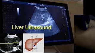 How to scan the Liver -Dr.Ismail Sayed Ismail