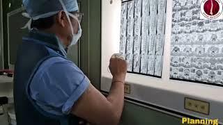 Daily Routine of a Neurosurgeon | Dr Pankaj Trivedi | Spine Masters