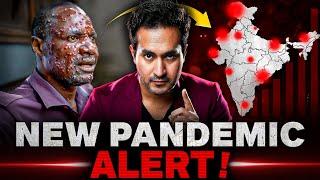 ALERT! New PANDEMIC is Spreading Across The World | MPOX Virus Explained