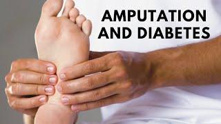 Amputation and diabetes: How to protect || BY HealthFirst All in 1