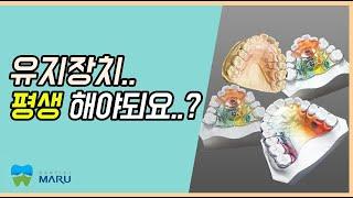 유지장치 기간? 진짜 평생 착용해야 되요?