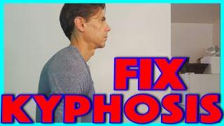 Fix Kyphosis (Hunchback Posture)