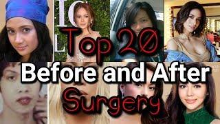 FILIPINO CELEBRITIES SHOCKING TRANSFORMATION BEFORE AND AFTER SURGERY | Showbiz Updates