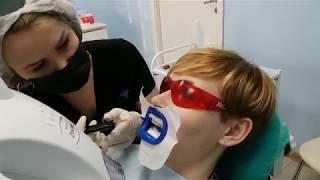 Отбеливание ZOOM4 в Bobrov Clinic