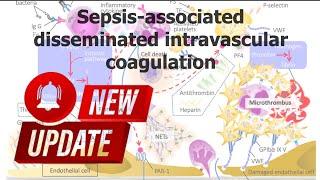 Sepsis associated  disseminated intravascular coagulation