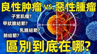 良性腫瘤vs惡性腫瘤 差別到底在哪裡！ 【癌症系列02】｜愛看報的kris