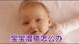 宝宝湿疹怎么办？|育儿技巧Parenting Tips:Baby Eczema