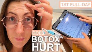 Botox before 30 | Getting 1ST TIME BOTOX Vlog