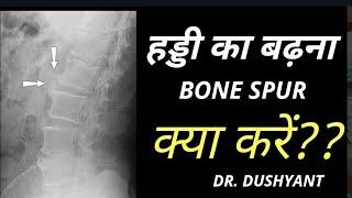 What is the growth of bones? Bone Spur and Osteophytes problems.