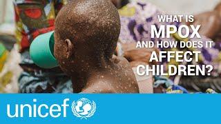 How to protect children from mPox? | UNICEF