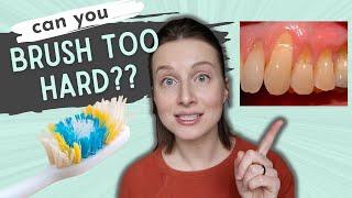 Can You Brush Too Hard? | Dental Tips + GIVEAWAY!