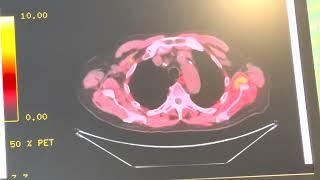 Dr. Edward Schaeffer's Interesting Case of the Week