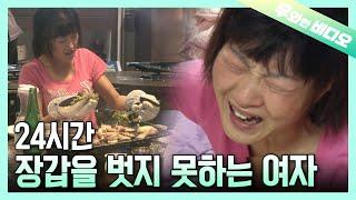 찜통더위에도 장갑을 벗을 수 없는 여자…그 이유는?┃The Woman Who Can't Take Off Her Gloves Even in Summer