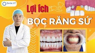 Bọc Răng Sứ - Lợi Ích Bọc Răng Sứ | Nha Khoa Smile HT