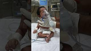 Baby pneumoniae and nebulization work  #baby #nebulizer #serious #condition #health #care #newborn