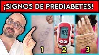 SIGNOS de PREDIABETES que SEGURO no CONOCIAS || ¿Cómo IDENTIFICAR una PREDIABETES?