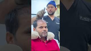 Cara PRP Hair Treatment for Hair Loss