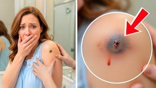 She Thought It Was Just A Mole - What Doctors Found Left Everyone In Shock!