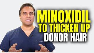 Can Minoxidil be used to thicken up donor hair post hair transplant surgery?