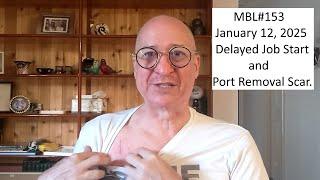 MBL#153. Job Start Delay. Port Removal Scar.