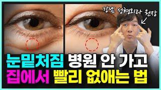 집에서 5분이면 눈밑지방, 눈밑꺼짐 해결 가능!ㅣ강남 성형외과 원장도 매일 하는 눈밑 처짐 없애는 법