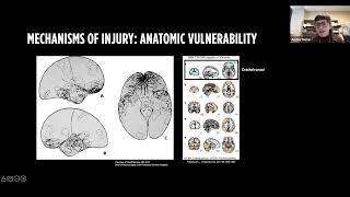 Maladaptive Microcircuits: Interrogating Selective Vulnerability after Traumatic Brain Injury